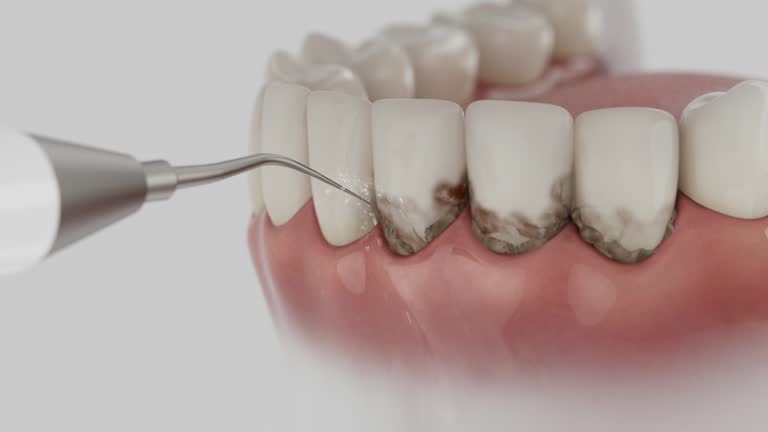 Reliable Dental contractor in Manitowoc, WI by Smile Center Dentistry